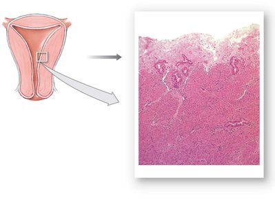 Histological section of endometrium during menstrual phase