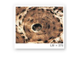 Cross-section view of an osteon