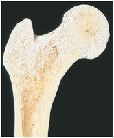 Spongy bone