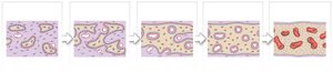 Intramembranous ossification