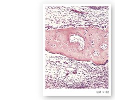 Details of intramembranous bone