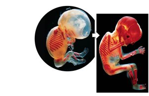 Photos of intramembranous ossification at 10 and 16 weeks of development