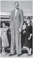 Example of gigantism
