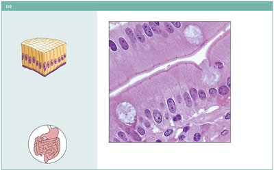 Simple columnar epithelium with goblet cells