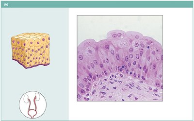 Transitional epithelium lining urinary bladder
