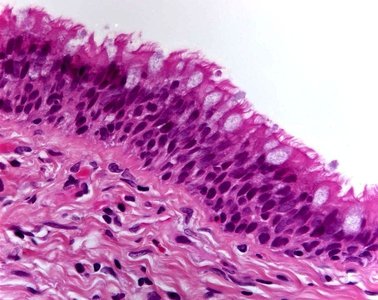 Transitional epithelium slide