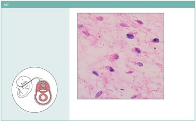 Mesenchymal tissue