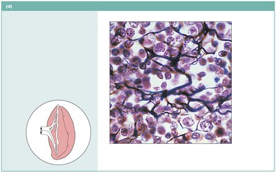 Reticular connective tissue