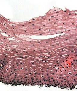 Stratified squamous epithelium slide