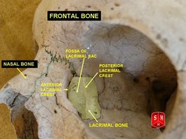 Lacrimal bones in the skull