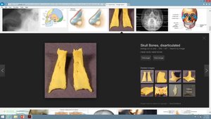 Nasal bones in the skull