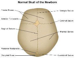 Normal skull of the newborn with fontanelles and sutures