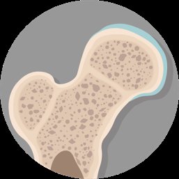 Epiphyseal plate and line close-up