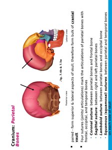 Parietal bones and sutures