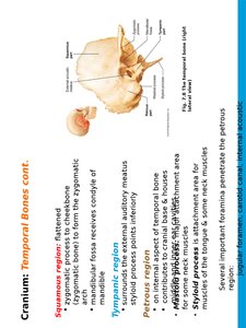 Sphenoid bone