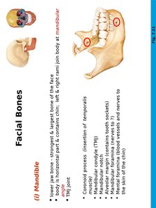 Maxillary bones