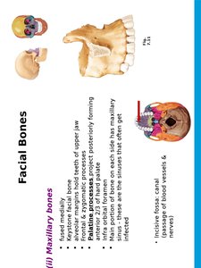 Zygomatic and nasal bones