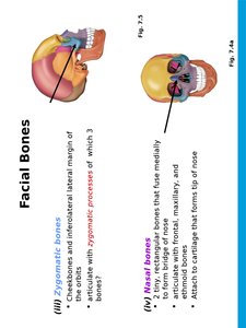Lacrimal, palatine, vomer, and inferior nasal conchae
