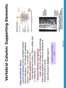 Typical vertebra structure