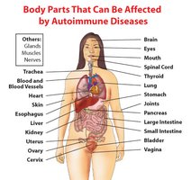 Body parts affected by autoimmune diseases