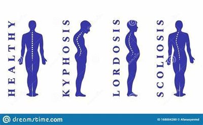 Normal and abnormal spinal curvatures