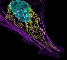 Mitochondria in a cell