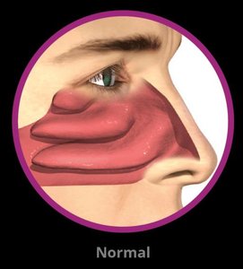 Regions of the pharynx: nasopharynx, oropharynx, laryngopharynx