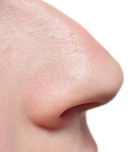External view of the human nose