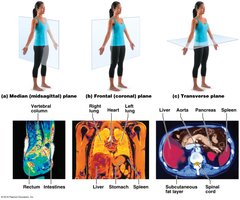Body planes and MRI scans