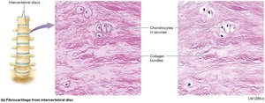 Fibrocartilage