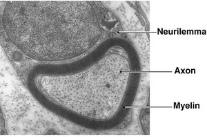 Electron micrograph of myelinated axon