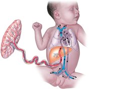 Diagram of fetal circulation showing the placenta, umbilical cord, and fetal heart with shunts