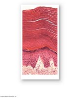Histological section of thick skin