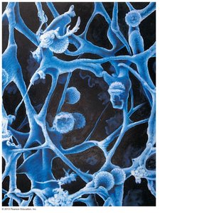 Reticular connective tissue in a human lymph node