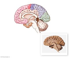 Midsagittal section of the brain