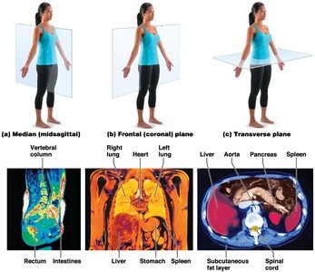 Body planes and MRI scans