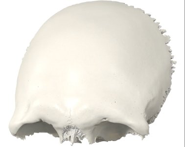 Superior view of the cranial vault