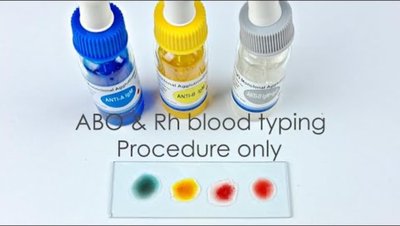 ABO and Rh blood typing procedure