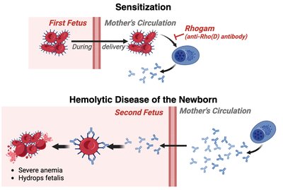 Hemolytic disease of the newborn and Rh sensitization