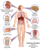 Symptoms of vitamin C deficiency