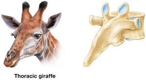 Superior view of the articulation between a rib and a thoracic vertebra