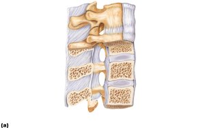 Sectioned vertebra showing ligaments and intervertebral disc