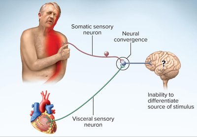 Referred pain mechanism