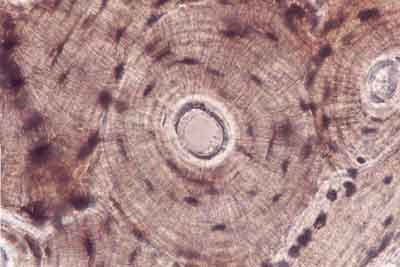 Microscopic image of compact bone (osteon)