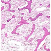 Histological image of spongy bone