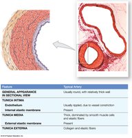 Comparison of a typical artery wall structure