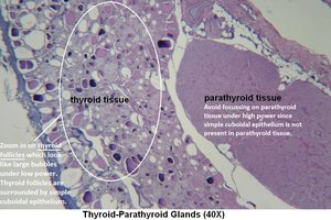 Diagram of thick and thin skin with labeled layers and accessory structures