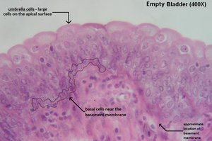 Transitional epithelium in empty bladder (400x)