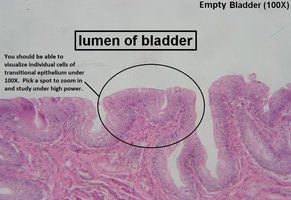 Transitional epithelium in empty bladder (100x)