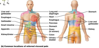 Common locations of referred visceral pain